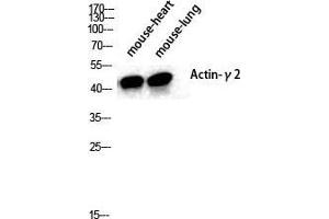Western Blot (WB) analysis of specific cells using Actin alpha3 Polyclonal Antibody. (Actin Alpha3 (N-Term) Antikörper)