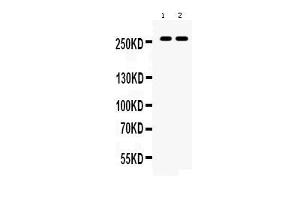 Western blot analysis of ABCA4 expression in rat eye extract ( Lane 1) and mouse eye extract ( Lane 2). (ABCA4 Antikörper  (C-Term))