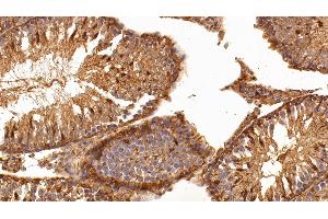 Immunohistochemistry (IHC) image for anti-Lectin, Galactoside-Binding, Soluble, 1 (LGALS1) (AA 1-135) antibody (ABIN7431629)
