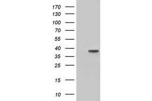 Western Blotting (WB) image for anti-3-hydroxyisobutyryl-CoA Hydrolase (HIBCH) antibody (ABIN1498655) (HIBCH Antikörper)