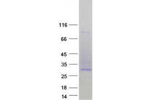 Western Blotting (WB) image for CD53 (CD53) (Transcript Variant 2) protein (Myc-DYKDDDDK Tag) (ABIN2713737)