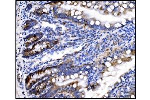 IHC analysis of HCCS using anti-HCCS antibody (ABIN7602424). (HCCS Antikörper  (AA 76-268))