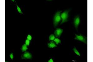 Immunofluorescence of monoclonal antibody to TRADD on HeLa cell.