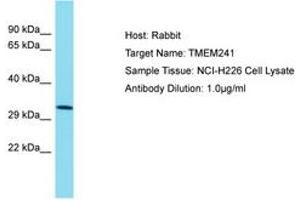 Image no. 1 for anti-Transmembrane Protein 241 (TMEM241) (AA 151-200) antibody (ABIN6750715) (TMEM241 Antikörper  (AA 151-200))