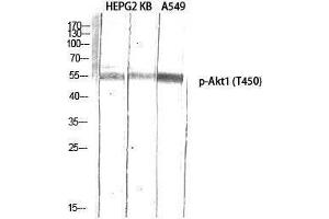 Western Blotting (WB) image for anti-V-Akt Murine Thymoma Viral Oncogene Homolog 1 (AKT1) (pThr450) antibody (ABIN3172849) (AKT1 Antikörper  (pThr450))