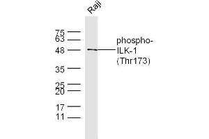 Raji cell lysates probed with Rabbit Anti-ILK-1(Thr173) Polyclonal Antibody, Unconjugated  at 1:500 for 90 min at 37˚C. (ILK Antikörper  (pThr173))