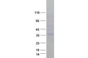 Western Blotting (WB) image for Corticotropin Releasing Hormone Binding Protein (CRHBP) protein (Myc-DYKDDDDK Tag) (ABIN2712558)