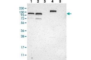ZBTB11 antibody