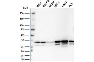 Western Blot Analysis of HeLa, HepG2, Jurkat, HEP2, U937, PC3 cell lysates using MDH1 Mouse Monoclonal Antibody (CPTC-MDH1-1). (MDH1 Antikörper)