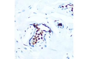 Immunohistochemistry of paraffin-embedded human breast using Phospho-c-Jun-T91 Rabbit mAb (ABIN7268057) at dilution of 1:100 (40x lens). (C-JUN Antikörper  (pThr91))