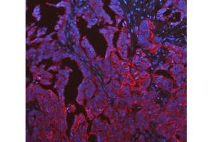 IF analysis of Cytokeratin 19 using anti-Cytokeratin 19 antibody (ABIN3043288).