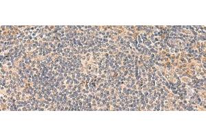 Immunohistochemistry of paraffin-embedded Human tonsil tissue using FUNDC2 Polyclonal Antibody at dilution of 1:50(x200)