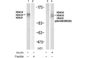 Image no. 1 for anti-HDAC4,HDAC5,HDAC9 (pSer220), (pSer246), (pSer259) antibody (ABIN319279) (HDAC4/HDAC5/HDAC9 Antikörper  (pSer220, pSer246, pSer259))