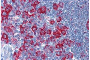 Immunohistochemistry (Formalin-fixed Paraffin-embedded Sections) (IHC (fp)) image for anti-Protein Kinase, Interferon-Inducible Double Stranded RNA Dependent Activator (PRKRA) (N-Term) antibody (ABIN6747048)