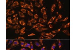 Immunofluorescence analysis of U-2 OS cells using ERK1 / ERK2 Polyclonal Antibody at dilution of 1:100 (40x lens). (ERK1/2 Antikörper)