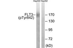 Western blot analysis of extracts from HepG2 cells treated with EGF 200ng/ml 30', using FLT3 (Phospho-Tyr842) Antibody. (FLT3 Antikörper  (pTyr842))