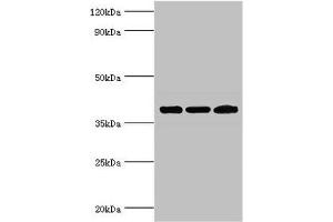 Western blot All lanes: Twinfilin-2 antibody at 3 μg/mL Lane 1: Jurkat whole cell lysate Lane 2: HepG2 whole cell lysate Lane 3: A431 whole cell lysate Secondary Goat polyclonal to rabbit IgG at 1/10000 dilution Predicted band size: 40 kDa Observed band size: 40 kDa (TWF2 Antikörper  (AA 1-349))
