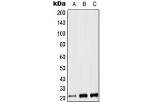 Western blot analysis of LIF expression in Jurkat (A), NIH3T3 (B), PC12 (C) whole cell lysates. (LIF Antikörper  (Center))