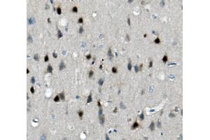 IHC analysis of Calretinin/CALB2 using anti-Calretinin/CALB2 antibody (ABIN7602106).