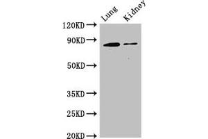 Western Blot Positive WB detected in: Mouse lung tissue, Mouse kidney tissue All lanes: CDH5 antibody at 3 μg/mL Secondary Goat polyclonal to rabbit IgG at 1/50000 dilution Predicted band size: 88, 75 kDa Observed band size: 88 kDa (Cadherin 5 Antikörper  (AA 349-569))