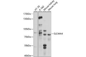 Western blot analysis of extracts of various cell lines, using SLC44 antibody (ABIN6130964, ABIN6148004, ABIN6148005 and ABIN6214687) at 1:1000 dilution. (SLC44A4 Antikörper  (AA 65-215))