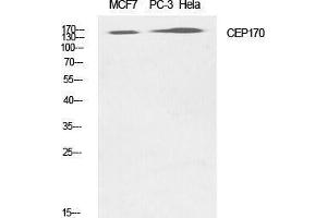 Western Blotting (WB) image for anti-Centrosomal Protein 170kDa (CEP170) (Internal Region) antibody (ABIN3174342) (CEP170 Antikörper  (Internal Region))