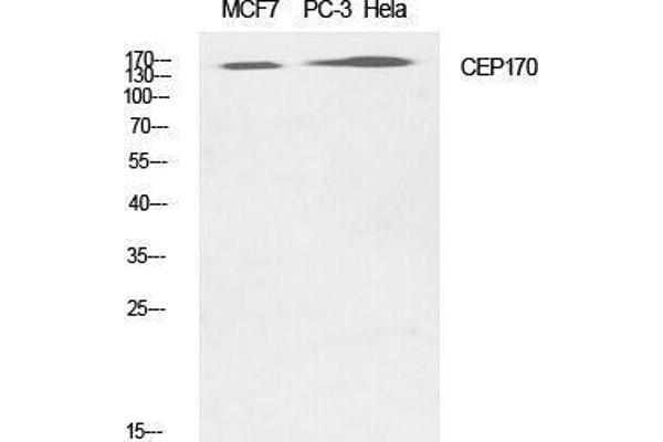 CEP170 Antikörper  (Internal Region)
