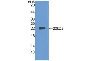PTPRN Antikörper  (AA 35-185)