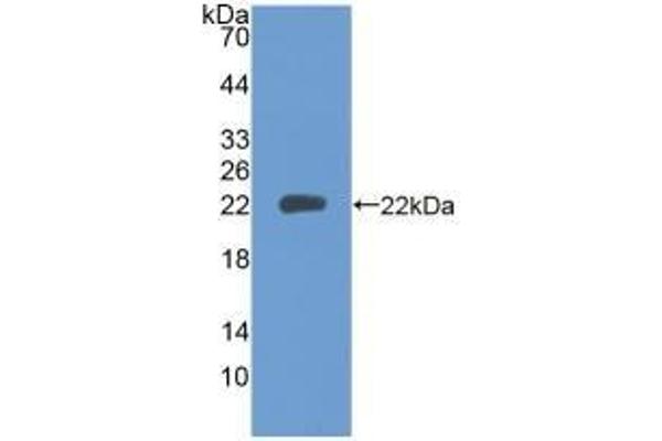 PTPRN Antikörper  (AA 35-185)
