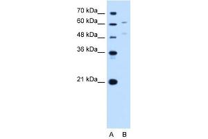 UGT1A4 antibody used at 1 ug/ml to detect target protein.