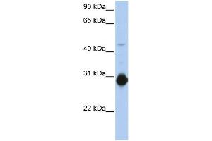 WB Suggested Anti-RHOU Antibody Titration:  0. (RHOU Antikörper  (C-Term))