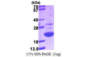 SDS-PAGE (SDS) image for Galectin-Related Protein (GRP) (AA 1-172) protein (His tag) (ABIN5780257)