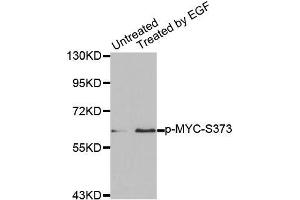 Western blot analysis of extracts from A431 cells using Phospho-MYC-S373 antibody (ABIN2987392). (c-MYC Antikörper  (pSer373))