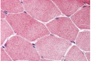 Human Skeletal Muscle (formalin-fixed, paraffin-embedded) stained with TSC1 antibody ABIN214014 at 5 ug/ml followed by biotinylated goat anti-rabbit IgG secondary antibody ABIN481713, alkaline phosphatase-streptavidin and chromogen. (TSC1 Antikörper  (C-Term))