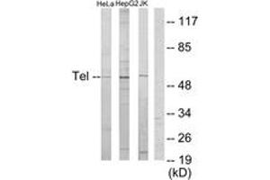 Western blot analysis of extracts from HeLa/HepG2/Jurkat cells, using ETV6 Antibody.