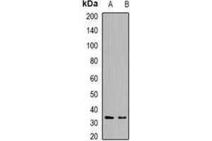Western blot analysis of DCK expression in Raji (A), HepG2 (B) whole cell lysates.