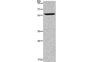 Western blot analysis of Human fetal brain tissue, using KDM4D Polyclonal Antibody at dilution of 1:1100