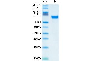Human FOLR1 on Tris-Bis PAGE under reduced condition. (FOLR1 Protein (AA 25-233) (Fc Tag))