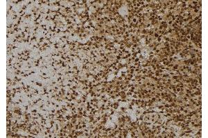 ABIN6256841 and ABIN6273600 at 1/100 staining Human spleen tissue by IHC-P. (MANSC1 Antikörper  (Internal Region))