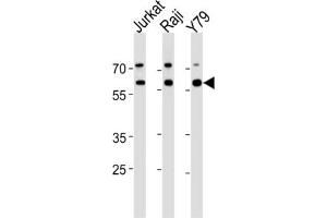 Western Blotting (WB) image for anti-Acetylcholinesterase (AChE) antibody (ABIN3003530)