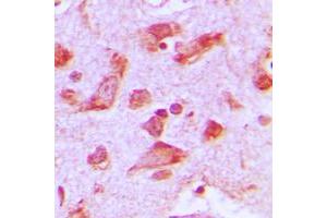 Immunohistochemical analysis of Praja2 staining in human brain formalin fixed paraffin embedded tissue section. (PJA2 Antikörper  (Center))