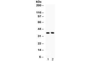 Western blot testing of human 1) PANC and 2) U87 cell lysate with FRZB antibody.