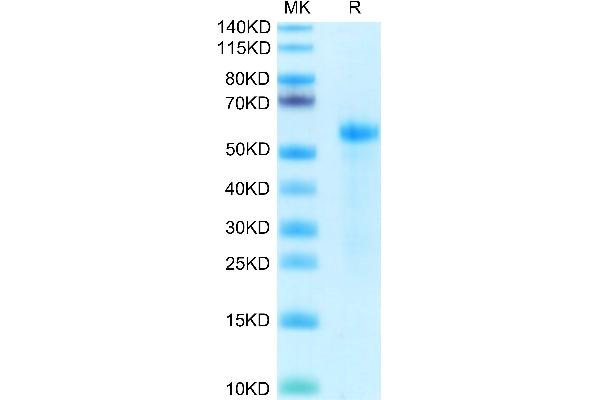 DLL3 Protein (AA 27-477) (His tag)