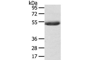 Western Blot analysis of Mouse plasma tissue using AGPAT6 Polyclonal Antibody at dilution of 1:400 (AGPAT6 Antikörper)
