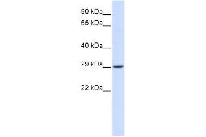 WB Suggested Anti-VTI1A Antibody Titration: 0. (VTI1A Antikörper  (N-Term))