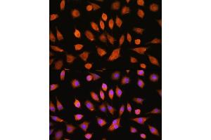 Immunofluorescence analysis of L929 cells using PI4KA Rabbit pAb (ABIN7269286) at dilution of 1:100. (PI4KA Antikörper)