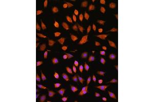 Immunofluorescence analysis of L929 cells using PI4KA Rabbit pAb (ABIN7269286) at dilution of 1:100.