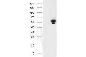 Western Blotting (WB) image for anti-Tumor Protein P53 (TP53) antibody (ABIN1499973)