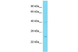 Host: Rabbit Target Name: PPP1R35 Sample Type: Jurkat Whole Cell lysates Antibody Dilution: 1. (PPP1R35 Antikörper  (N-Term))