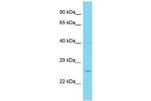 Host: Rabbit Target Name: PPP1R35 Sample Type: Jurkat Whole Cell lysates Antibody Dilution: 1.